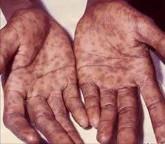 disease